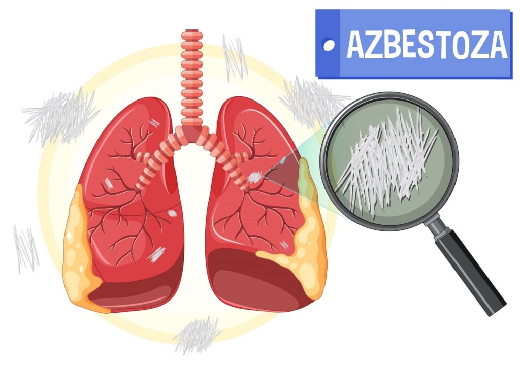 Azbestul si Azbocimentul: Definitie si termeni legislativi